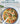 The Essential Diet for Diverticulitis: A 3-Stage Nutrition Guide to Manage and Prevent Flare-Ups